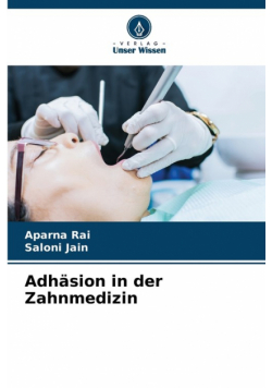 Adhäsion in der Zahnmedizin