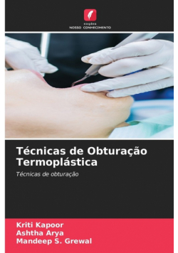 Técnicas de Obturação Termoplástica