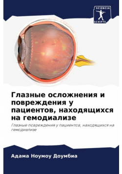 Глазные осложнения и повреждения у пациентов, находящихся на гемодиализе