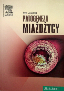 Patogeneza miażdżycy