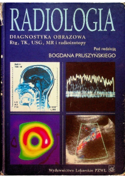 Radiologia Diagnostyka obrazowa RTG TK USG MR i radioizotopy