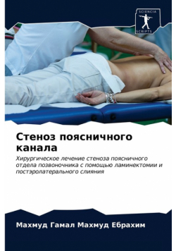 Стеноз поясничного канала