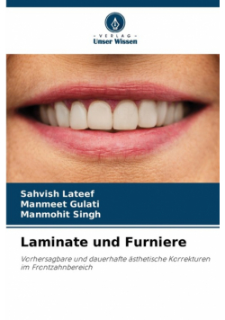 Laminate und Furniere