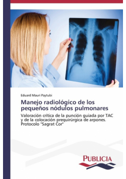 Manejo radiológico de los pequeños nódulos pulmonares