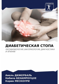 ДИАБЕТИЧЕСКАЯ СТОПА