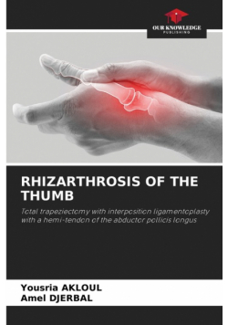 Rhizarthrosis Of The Thumb
