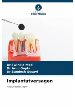Implantatversagen