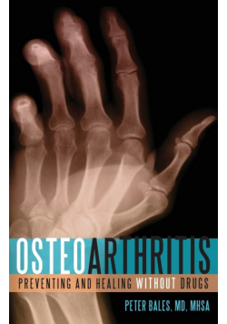 Osteoarthritis