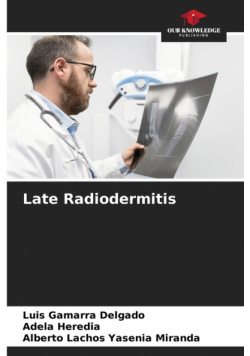 Late Radiodermitis