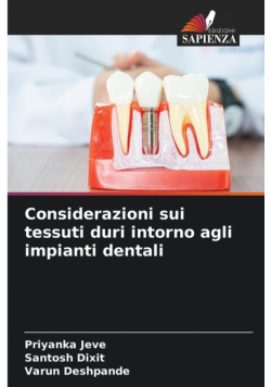 Considerazioni sui tessuti duri intorno agli impianti dentali