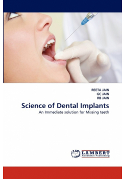 Science of Dental Implants