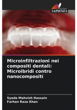 Microinfiltrazioni nei compositi dentali