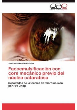 Facoemulsificación con core mecánico previo del núcleo cataratoso