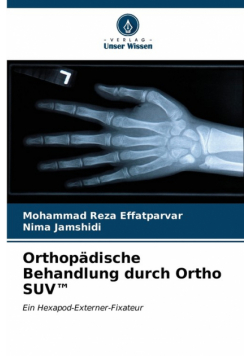 Orthopädische Behandlung durch Ortho SUV™