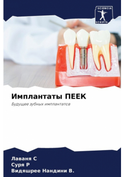 Имплантаты ПЕЕК
