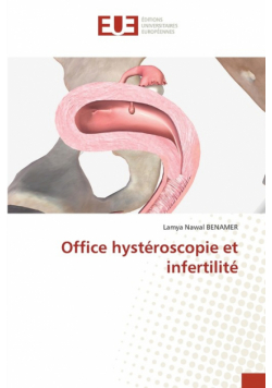 Office hystéroscopie et infertilité