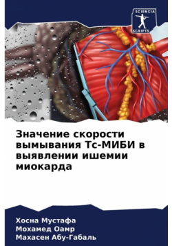 Значение скорости вымывания Тс-МИБИ в выявлении ишемии миокарда