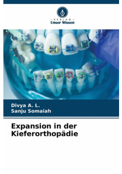 Expansion in der Kieferorthopädie