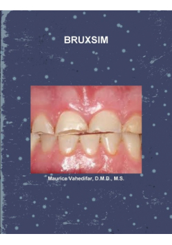 Bruxsim