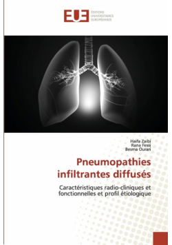 Pneumopathies infiltrantes diffusés