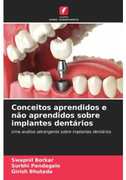 Conceitos aprendidos e não aprendidos sobre implantes dentários