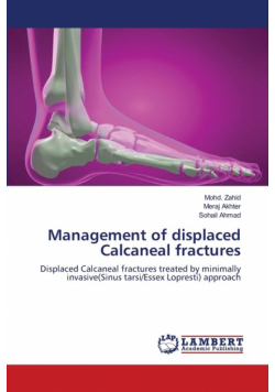 Management of displaced Calcaneal fractures