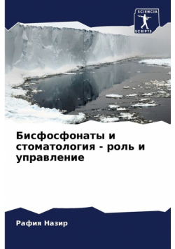 Бисфосфонаты и стоматология - роль и управление