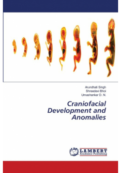 Craniofacial Development and Anomalies