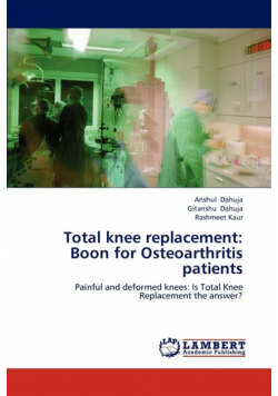 Total knee replacement