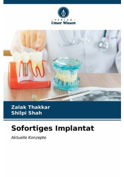 Sofortiges Implantat