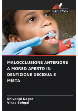 Malocclusione Anteriore A Morso Aperto In Dentizione Decidua E Mista