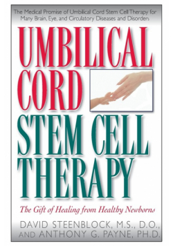 Umbilical Cord Stem Cell Therapy