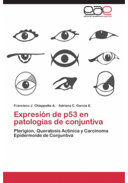 Expresion de P53 En Patologias de Conjuntiva