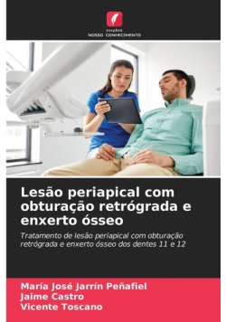 Lesão periapical com obturação retrógrada e enxerto ósseo