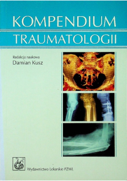 Kompendium traumatologii