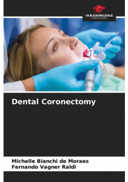 Dental Coronectomy