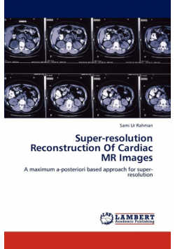 Super-resolution Reconstruction Of Cardiac MR Images