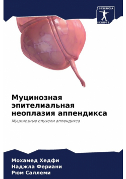 Муцинозная эпителиальная неоплазия аппендикса
