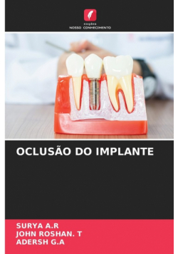 Oclusão Do Implante
