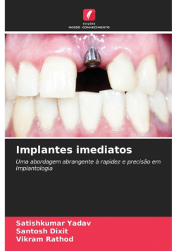 Implantes imediatos