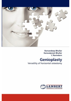 Genioplasty