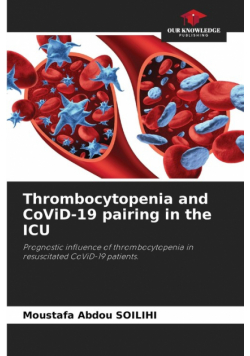 Thrombocytopenia and CoViD-19 pairing in the ICU