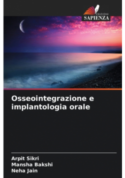 Osseointegrazione e implantologia orale