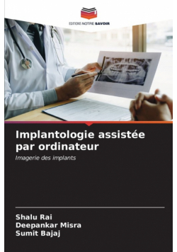 Implantologie assistée par ordinateur