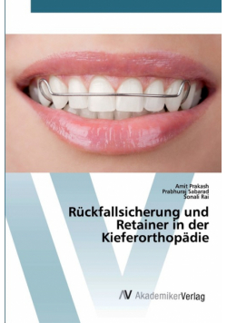Rückfallsicherung und Retainer in der Kieferorthopädie