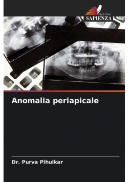 Anomalia periapicale