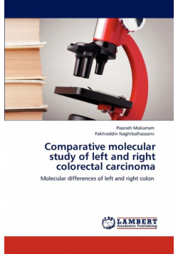 Comparative molecular study of left and right colorectal carcinoma