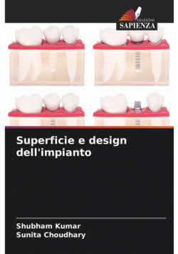 Superficie e design dell'impianto
