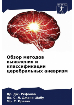 Обзор методов выявления и классификации церебральных аневризм