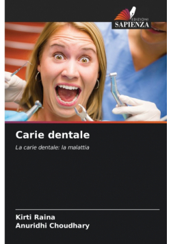 Carie dentale